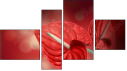 Фортык
